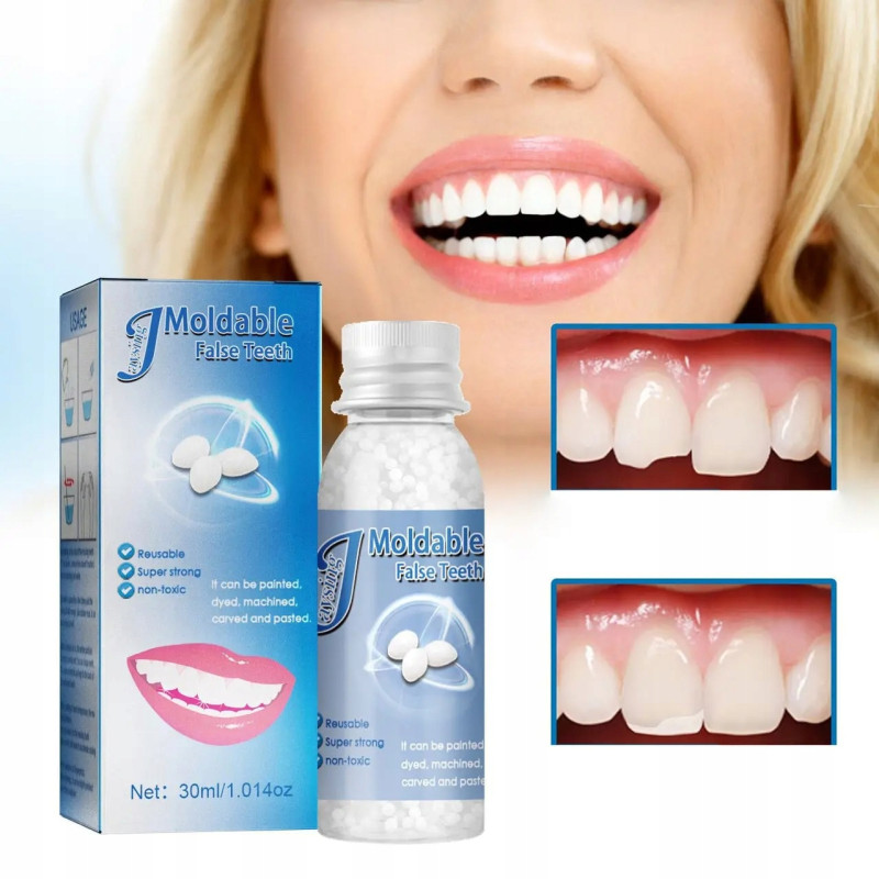 Kit de reparación de dientes temporales 30 ml Kit de reparación de dentaduras postizas: un kit rápido y seguro para reparar dientes rotos o faltantes.